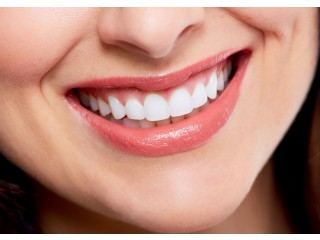 "From Ordinary to Extraordinary: How a Hollywood Smile Makeover in Dubai Can Transform Your Life!"