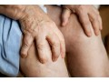 beast-rheumatoid-arthritis-treatment-in-raipur-dr-pratik-dhabalia-small-0