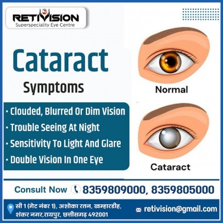 are-you-searching-best-cataract-surgery-treatment-in-raipur-retivision-superspeciality-eye-centre-big-0