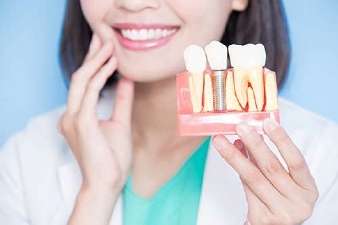 the-role-of-cosmetic-dentistry-in-achieving-natural-looking-dental-implants-big-0