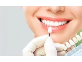 Maintaining and Caring for Dental Veneers in Thane