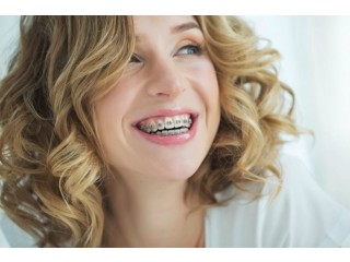 Transform Your Smile: The Ultimate Guide To Dental Braces Treatment In Thane With Smile Wellness