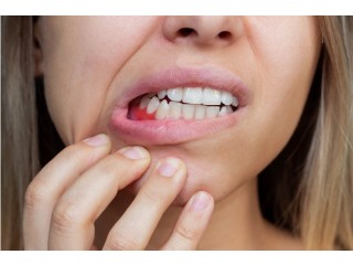 Best Gum Treatment in BTM Layout - Perfect Dental Studio