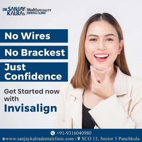 invisible-braces-for-adults-dr-sanjay-kalra-dental-clinic-big-0