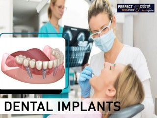 Best Dental Implants in BTM Layout, Bangalore - Perfect Dental Studio
