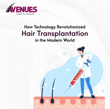 best-hair-transplant-in-ahmedabad-avenues-cosmetic-big-0